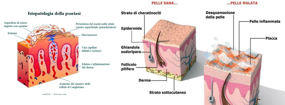 Dermatologo a Chiavari, La spezia, Brugnato